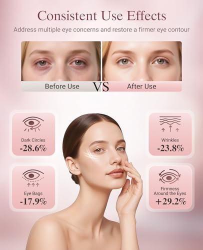 Red Light Therapy for Eyes, Wireless Under-Eye Red Light Therapy Mask with Timing Function, 3 Modes with Near-Infrared for Eyes Bags, Dark Circles, Fine Lines, Rechargeable Home Skincare Eye Mask