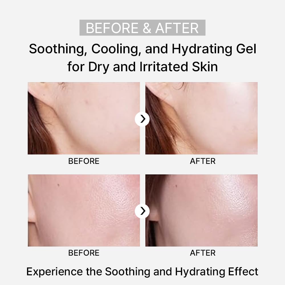 ARZTIN Rejuvenation Pflege Gel, Moisturizing Smoothing Cooling Gel Essence, Soothing Refreshing Non-Sticky Gel, Soothing and Hydrating Aloe Vera for Dry & Sensitive Skin