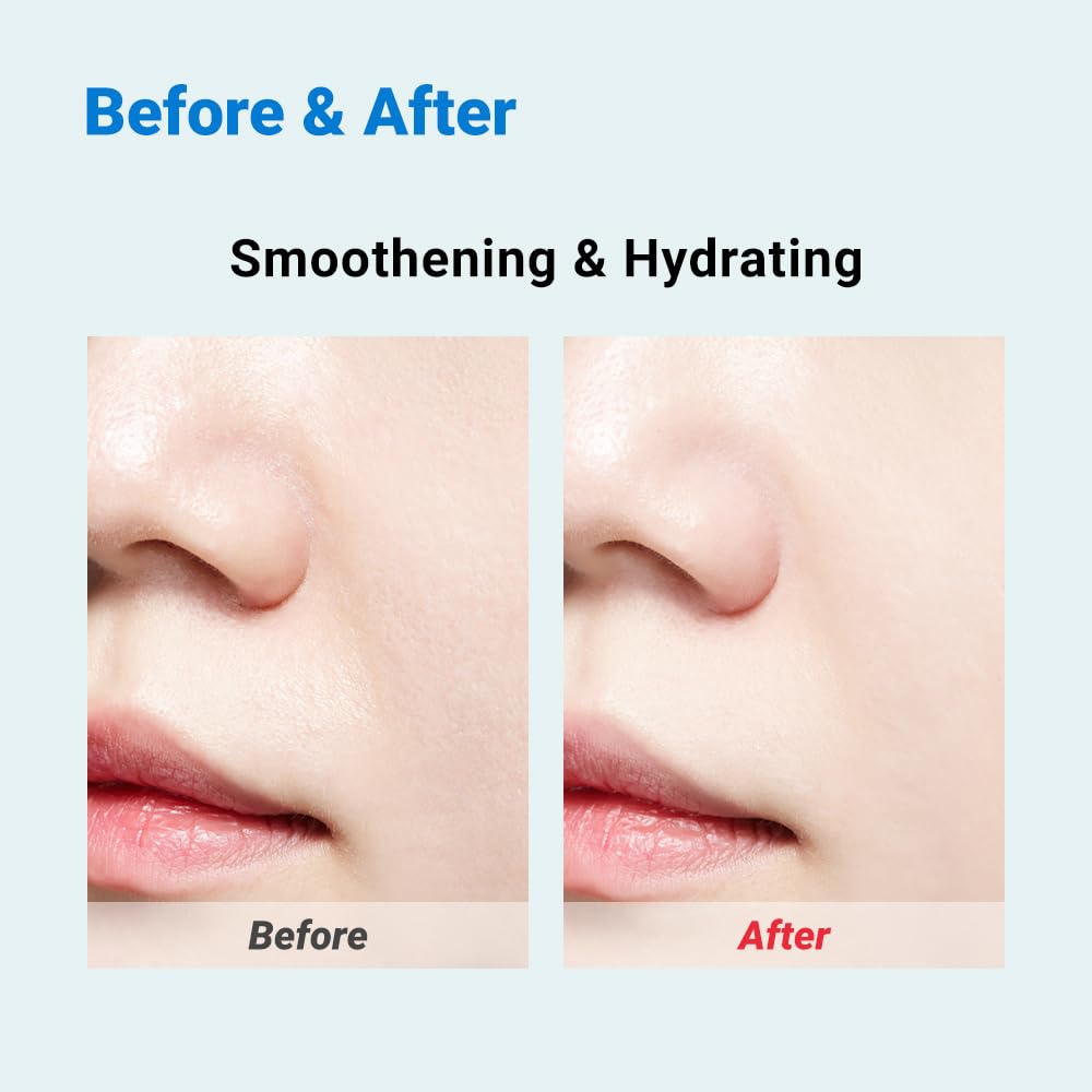 Real Barrier Aqua Soothing Ampoule Pad, 70 Pads l Hyaluronic Acid Facial Serum | Redness Relief for Sensitive Skin | Facial Moisturizer for Dry Skin| Calming Chamomile Extract| Korean Skincare