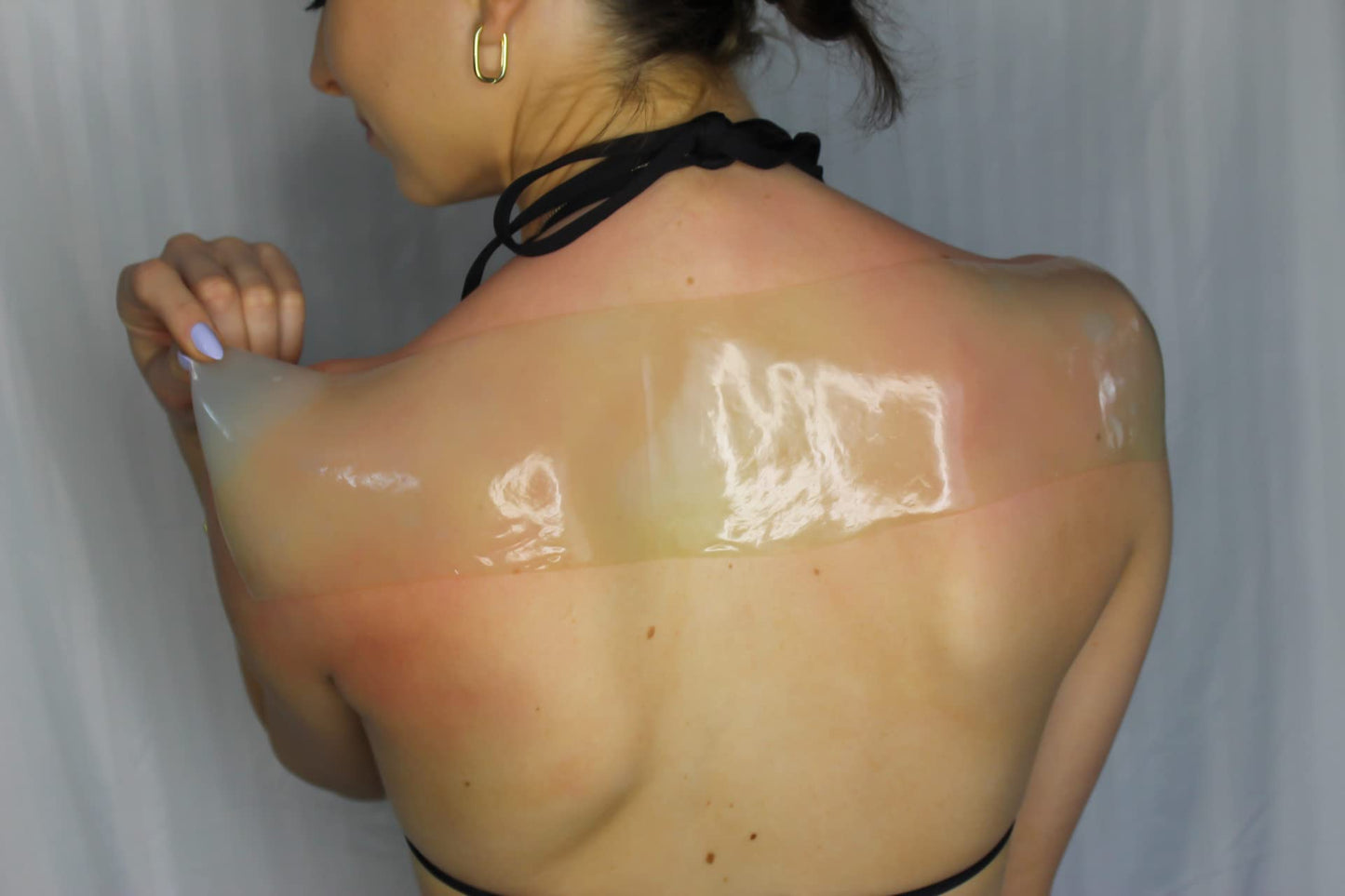 TermaBurn Aloe Wrap for Sunburn Relief – Hydro-Gel Aftersun Treatment with 100% pure aloe vera Gel | Second Skin aloevera gel for burns and peeling irritation | Great for Tattoo Aftercare and Sun Care