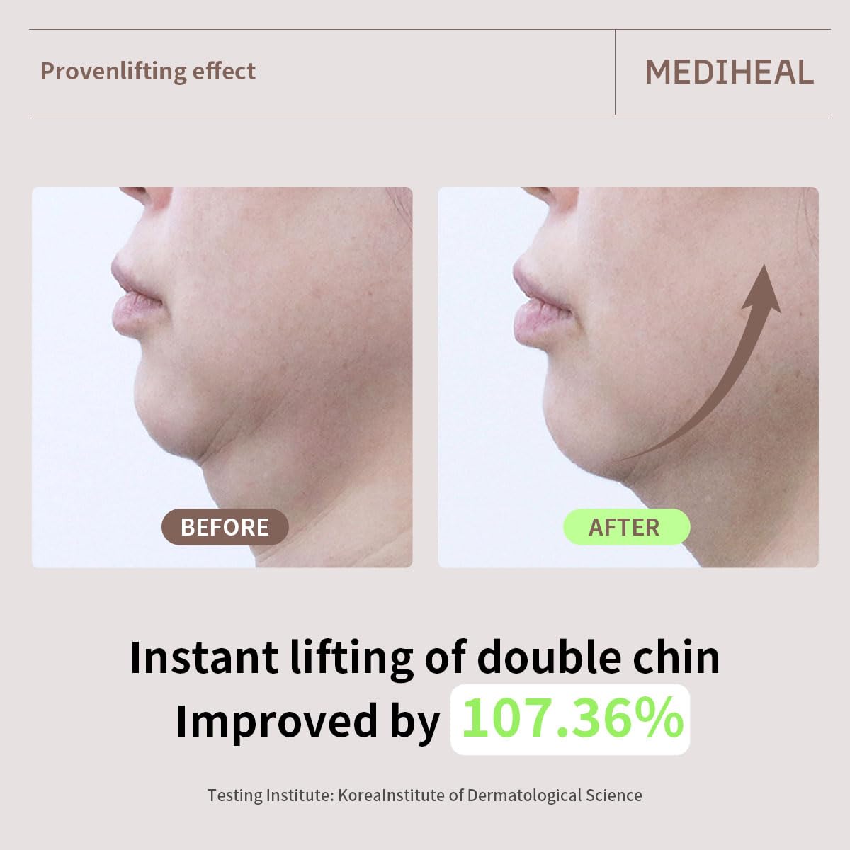 Mediheal Retinol Collagen Cream Lifting Mask (4 Counts) for V Line Mask,Anti-Aging - Helps Reduce Fine Lines & Wrinkles, and Smoothens Skin