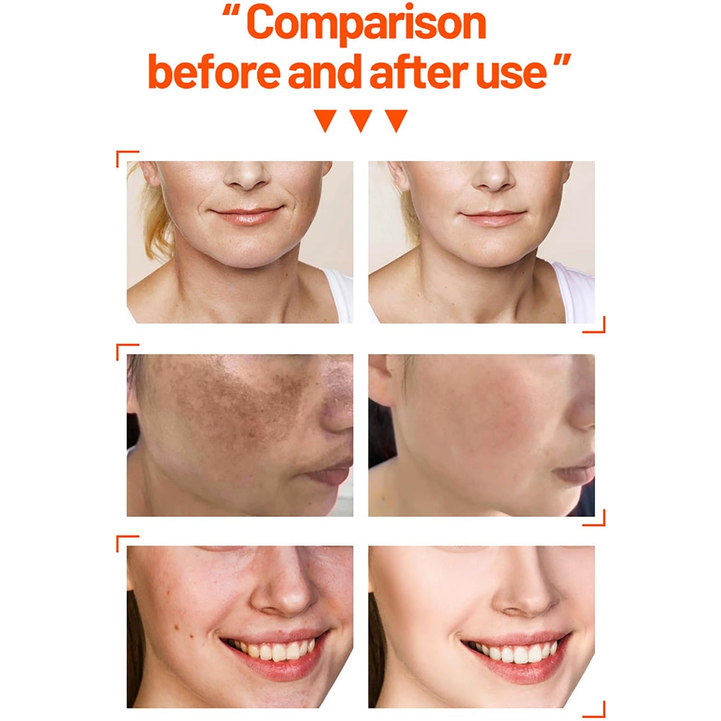 DISAAR BEAUTY Vitamin C Organic Orange Extract Skin Care Set Facial Wash Toner Serum Face Cream Moisturizing Reduce Wrinkles Hydrate 30ml+30ml+10ml+15g 4PCS