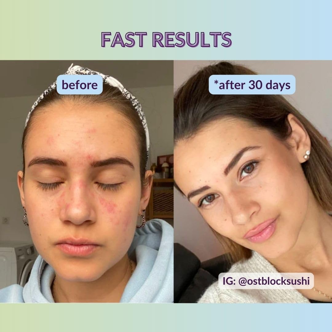 Hyaluronic Acid Moisturiser Gel with Organic Aloe Vera - NATURAL VEGAN COSMETICS - 100ml - Intensive Hydration - Anti-Ageing and Anti-Wrinkle Face Care for Men and Women