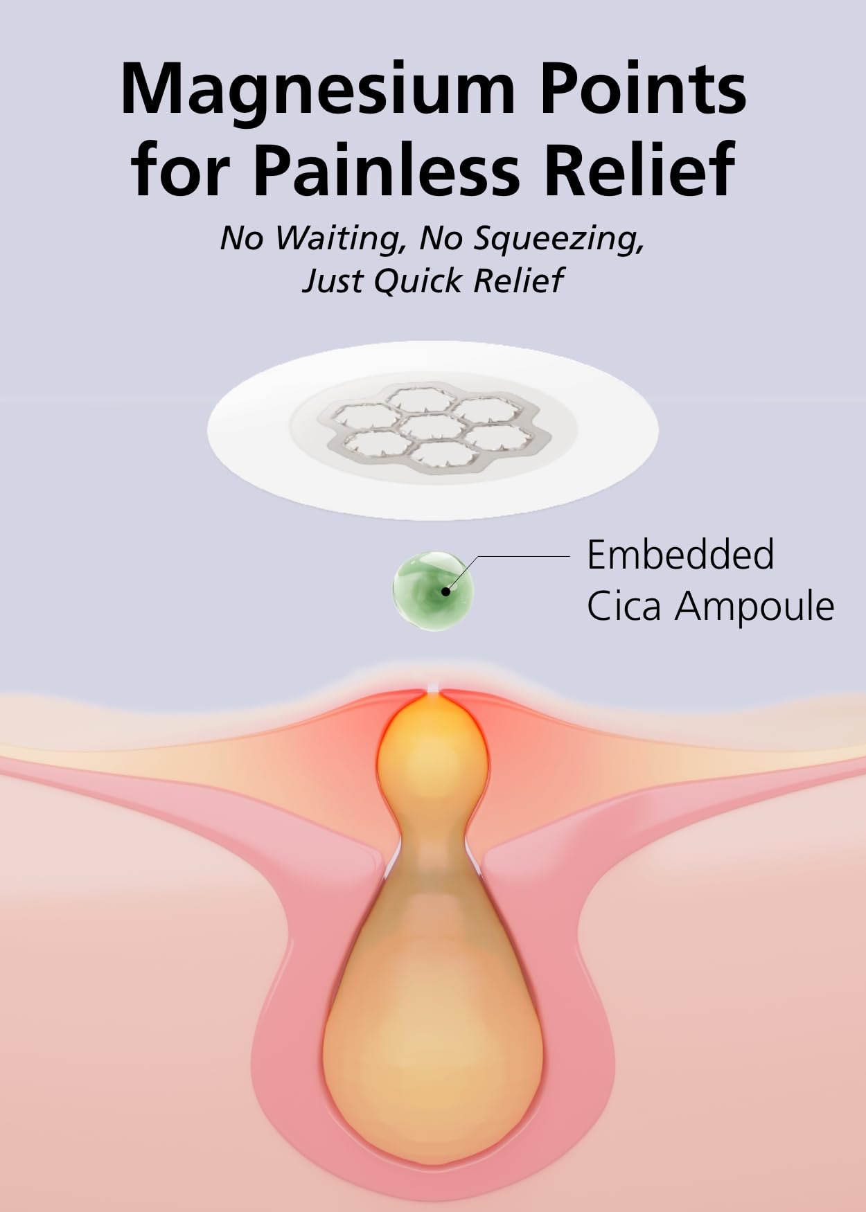 DWEasyDerm Quick Calming Magnesium Patches(20 patches) with Cica Ampoule - Intensive Care, Pimple patches, Hydrocolloid Band, Zits Spot care Overnight Home Care 2-8 hours, New boxs types