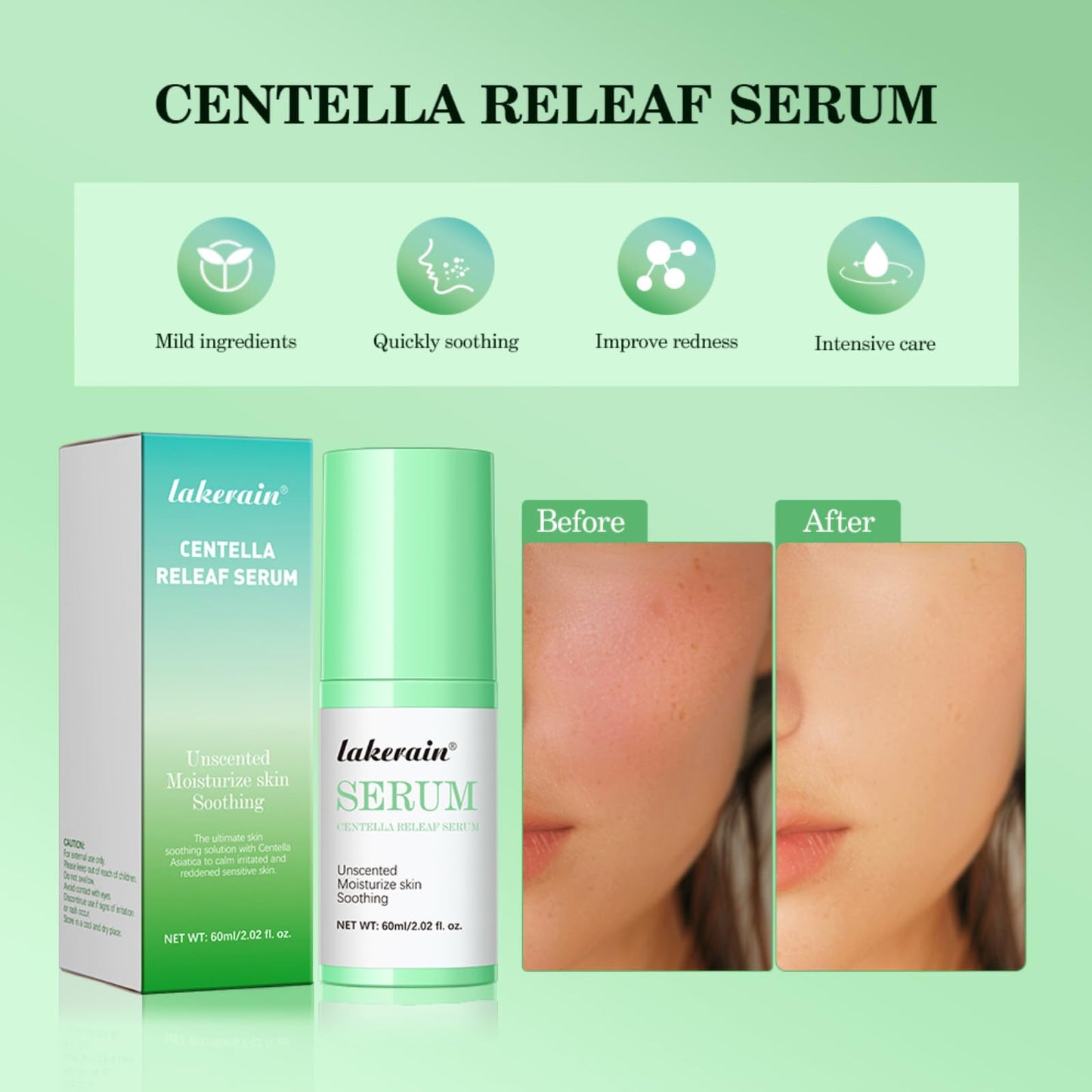 NICEFACE Centella Releaf Serum, Soothing, Calming, Facial Serum for face, Vegan & Cruelty-Free