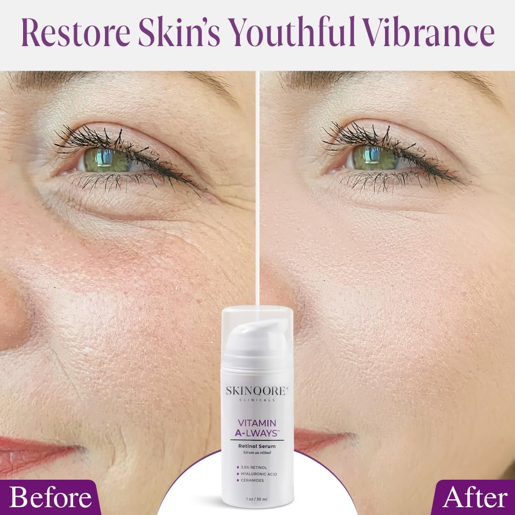 Retinol Serum with Hyaluronic Acid, Ceramides Vitamin A & Antioxidants | Anti Wrinkle Glass Skin Care | Dark Spot Remover for Face | Gently Exfoliates | Fragrence Free & Plant Based - 1 Oz