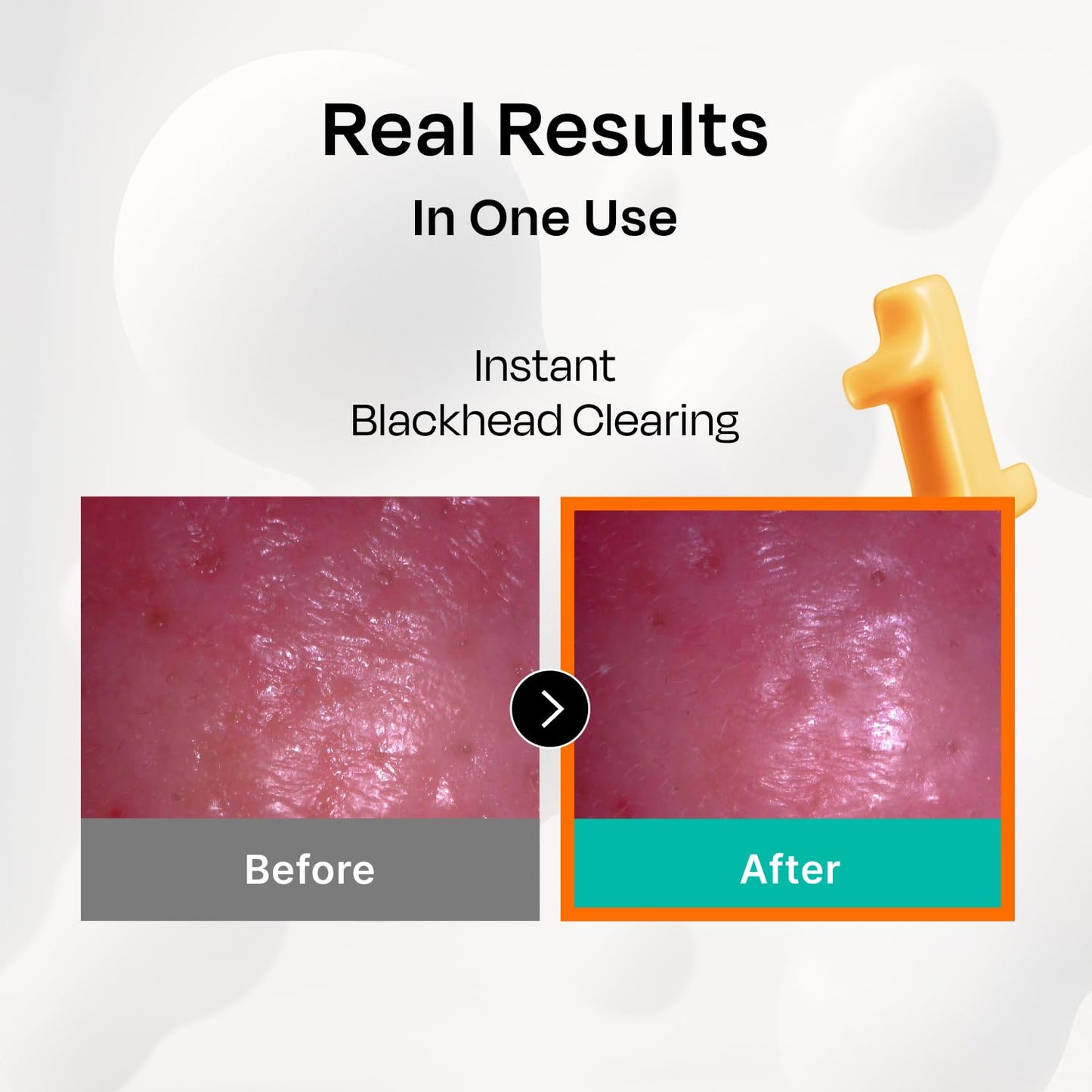 Celladix Bio Pore Care Cellulose Mask – Pore Minimizing & Sebum Control Sheet Mask – Removes Blackheads, Dead Skin Cells & Impurities – Hydrating & Radiance Boost Korean Face Mask, 5 Sheets