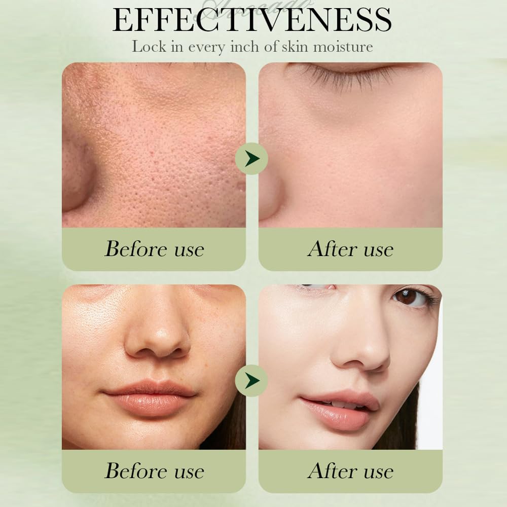 7pcs Avocado Skincare Kit, Skin Care Gift Set with Facial Cleanser, Toner, Lotion, Face Serum, Face Cream, Eye Cream, Lip Balm For Hydrating Skin Anti-Aging Skin For Women Teen Girls (7 Count)