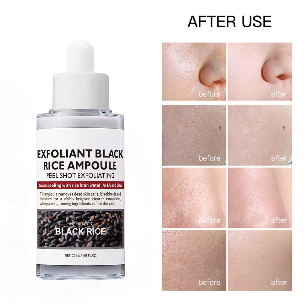 Rice Peeling Ampoule, Soft Exfoliating, Dead Skin and Blackheads Remover, Moisturizing, Travel-Friendly For All Skin Types
