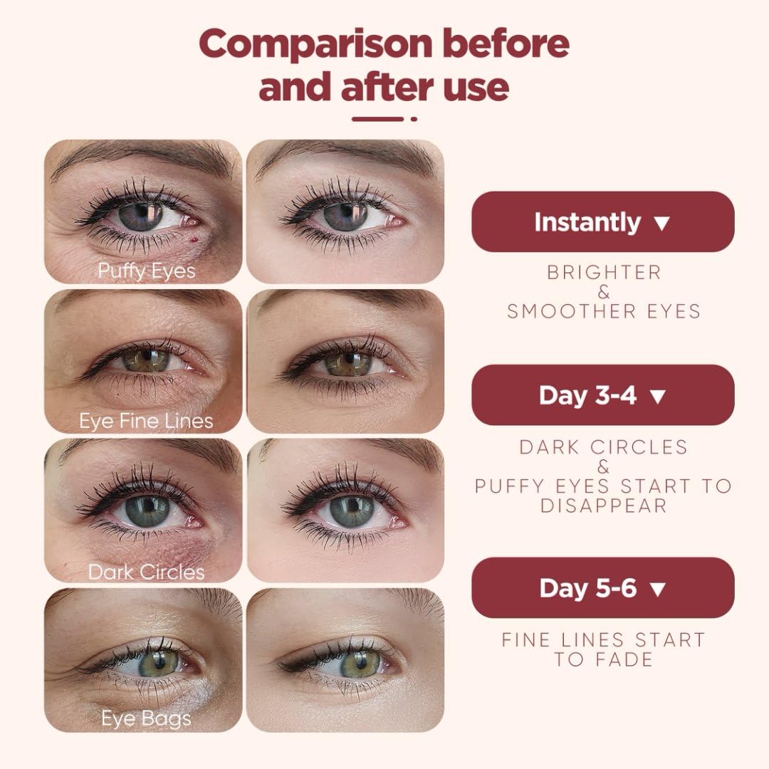 Rokelos Under Eye Patches (20 Pairs), pink Hyaluronic Acid Eye Patches For Puffy Eyes, Dark Circles, Puffiness, Refresh,Revitalizing, Wrinkles, Anti Aging & Face Moisturizer For Women and Men