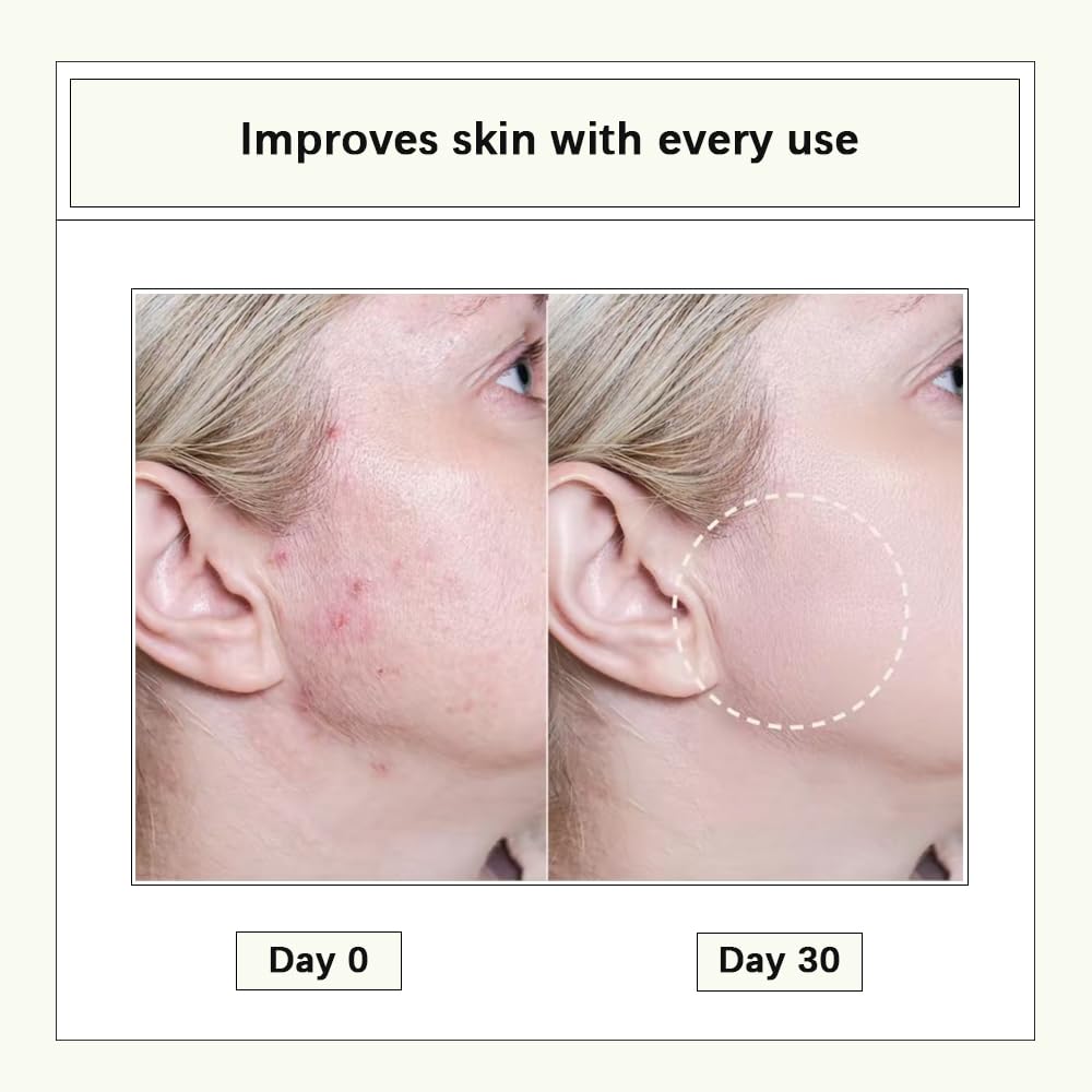 CISTTO Natural Cleansing Oil - Mini Lightweight Balancing Makeup Remover with Jojoba & Rose Oil, Non-Comedogenic, Travel Size 2ml x 40 Capsules for Oily Skin