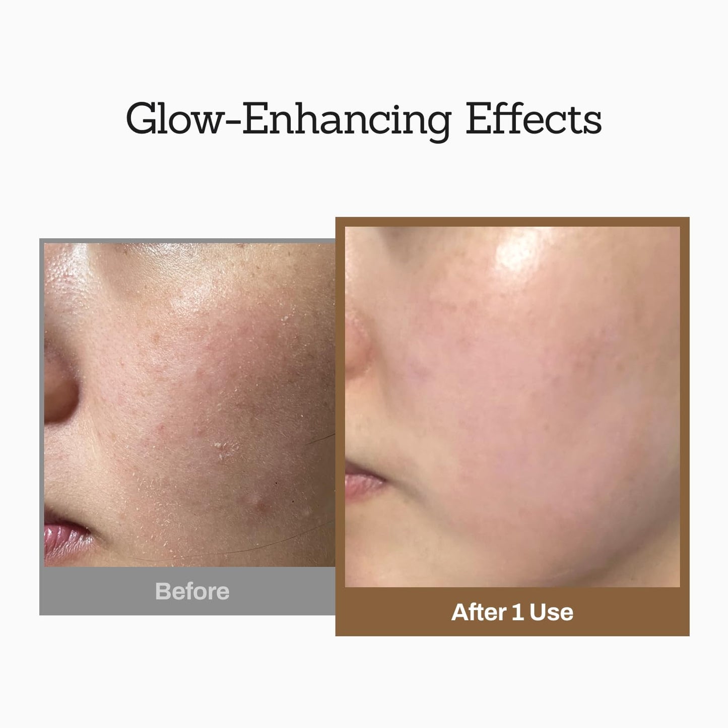 Rice Wash-Off Mask - Korean Glass Skin Face Mask Skincare - Hydrating Rice Clay Mask for Face - Natural Exfoliants Gently Improve Skin Texture, Even Skin Tone, and Restore Radiant Glow, 6.76 fl.oz