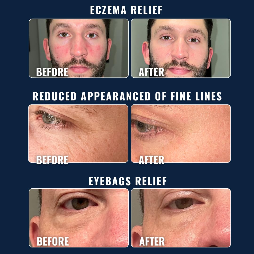 Prettyboy Face Revival Gel Moisturizer For Men - Hydrating Cream That Refreshes Dry Skin, Irritation, & Redness - Supports Anti Aging & Anti Wrinkle - Fragrance Free - 3 Count