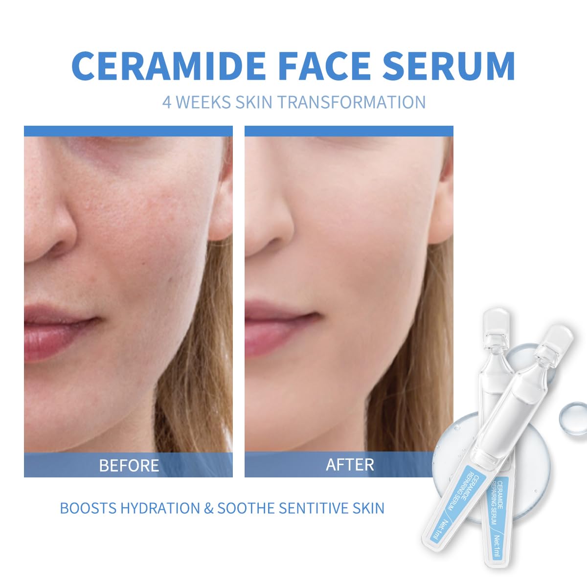 Repairing & Hydrating Face Serum with Ceramide NP, Hyaluronic Acid, Carnosine & Vitamin E | Moisturizing Ampoules for All Skin Types | Anti-Aging & Soothing Serum, 15 Pcs/Box