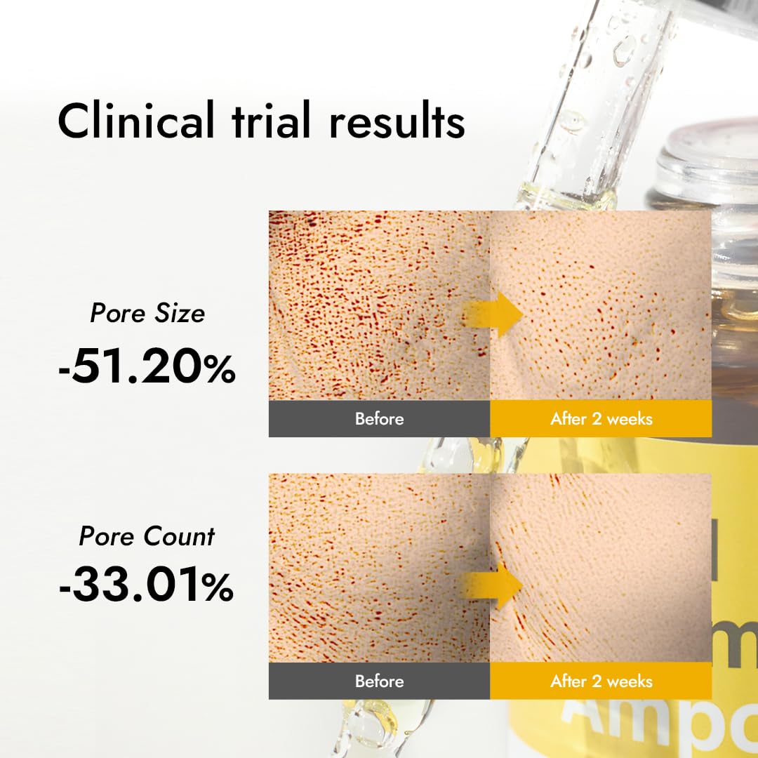 MIZON Real Vitamin C Ampoule, Pure Vitamin C, No Water Added,10 Ingredients, Nutrition, Face Moisturizer (0.51 fl. Oz)