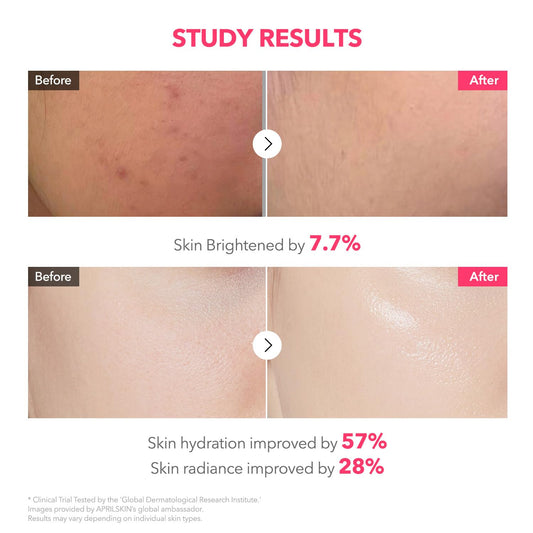 APRILSKIN TXA Pink Capsule Gel Mask | Overnight Face Mask for Glass Glow Skin I 99% High-Purity Tranexamic Acid 3 for uneven skin tone I Elasticity, Hydrating and Firming I Korean Skincare I 30g x 4ea