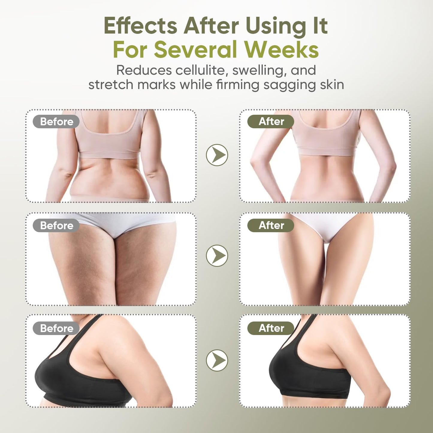 Body Sculpting Machine — Lymphatic Drainage Massager & Anti Cellulite Massage Tool,with Microcurrent, Light Heat & Vibration for Legs, Arms & Belly, Body,Helps Reduce Stretch Marks & Cellulite