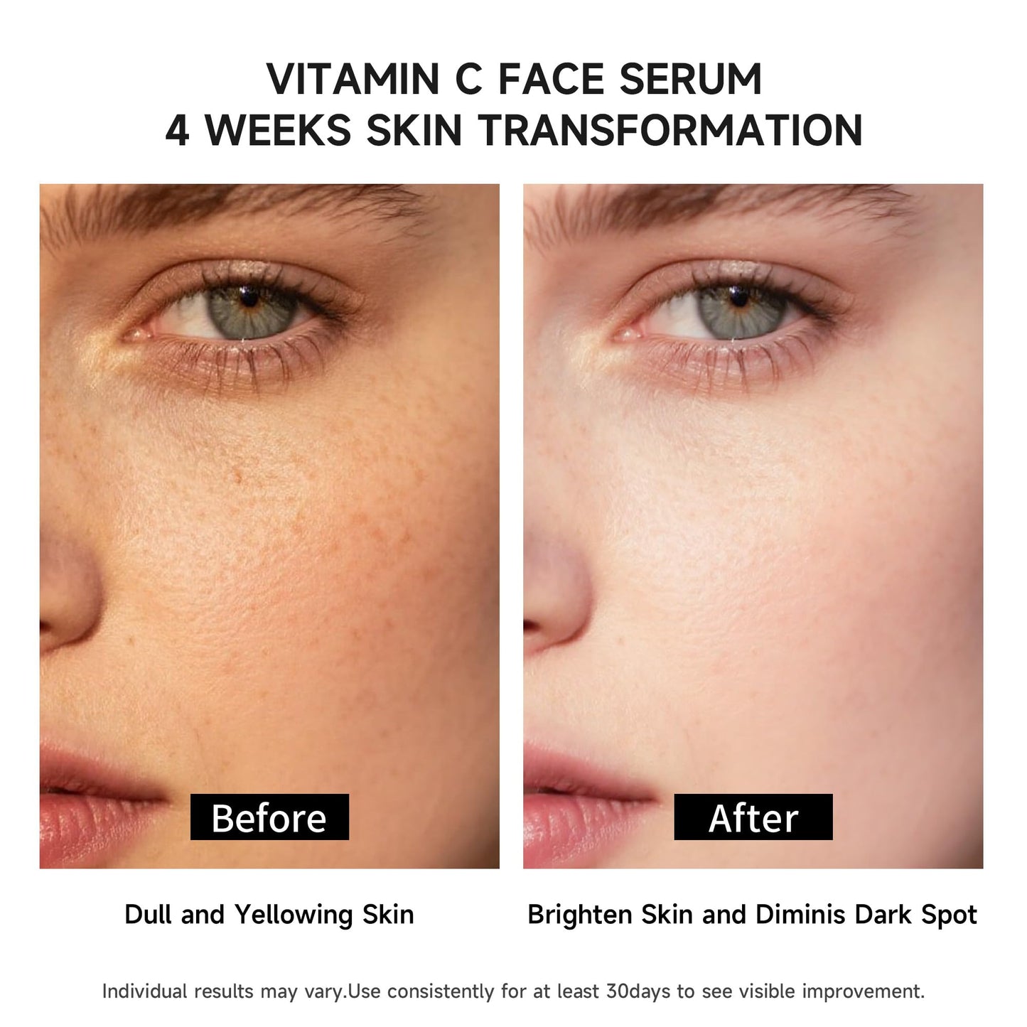 Vitamin C Face Serum with Glutathione, 4D Hyaluronic Acid & Aloe Vera – Lightweight Brightening & Hydrating Ampoule for Daily Skincare, Dark Spots, Sensitive Skin Friendly - 15 Ampoules (1ml each)