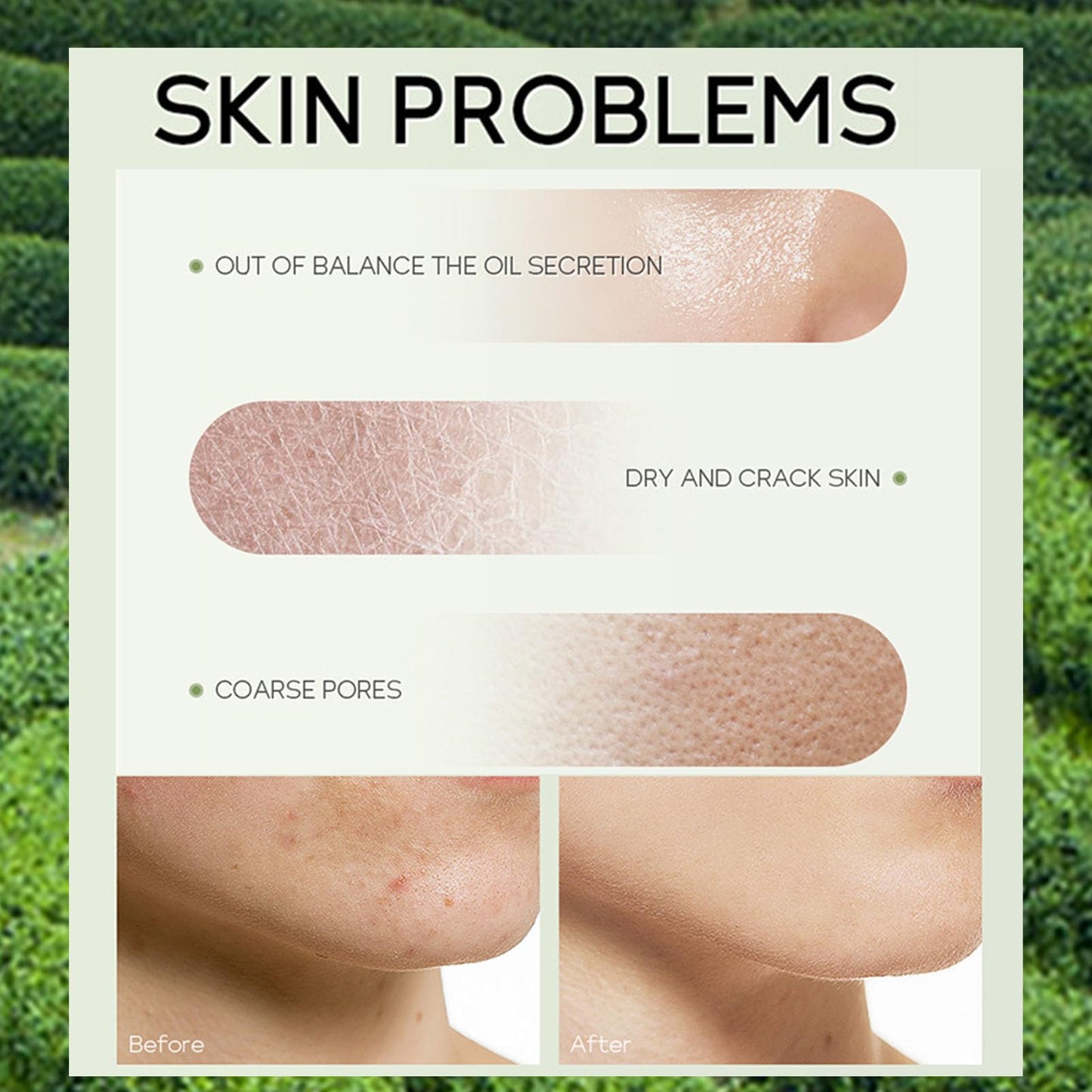 Green Tea Skincare Set, 5 Pcs Skincare Gift Set with Cleanser, Face Serum, Face Cream, Eye Cream, Toner , Skincare Kits For Teen Girls, Hydrating Facial Kit For Women