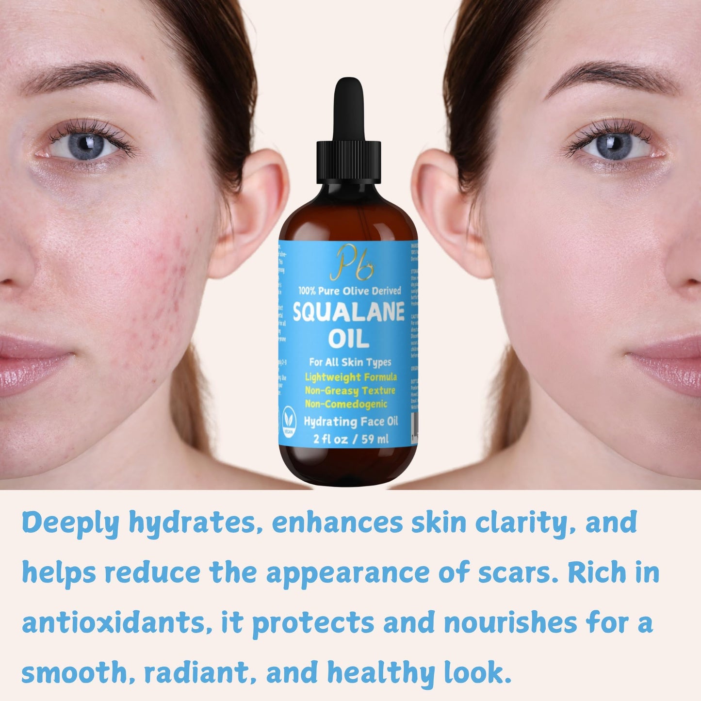 Squalane Oil – 100% Plant-Derived, Lightweight & Fast-Absorbing Squalane Face Oil for Anti-Aging, Dry Skin, Hair & Body | Non-Greasy, Non-Comedogenic Moisturizer | 2 fl oz