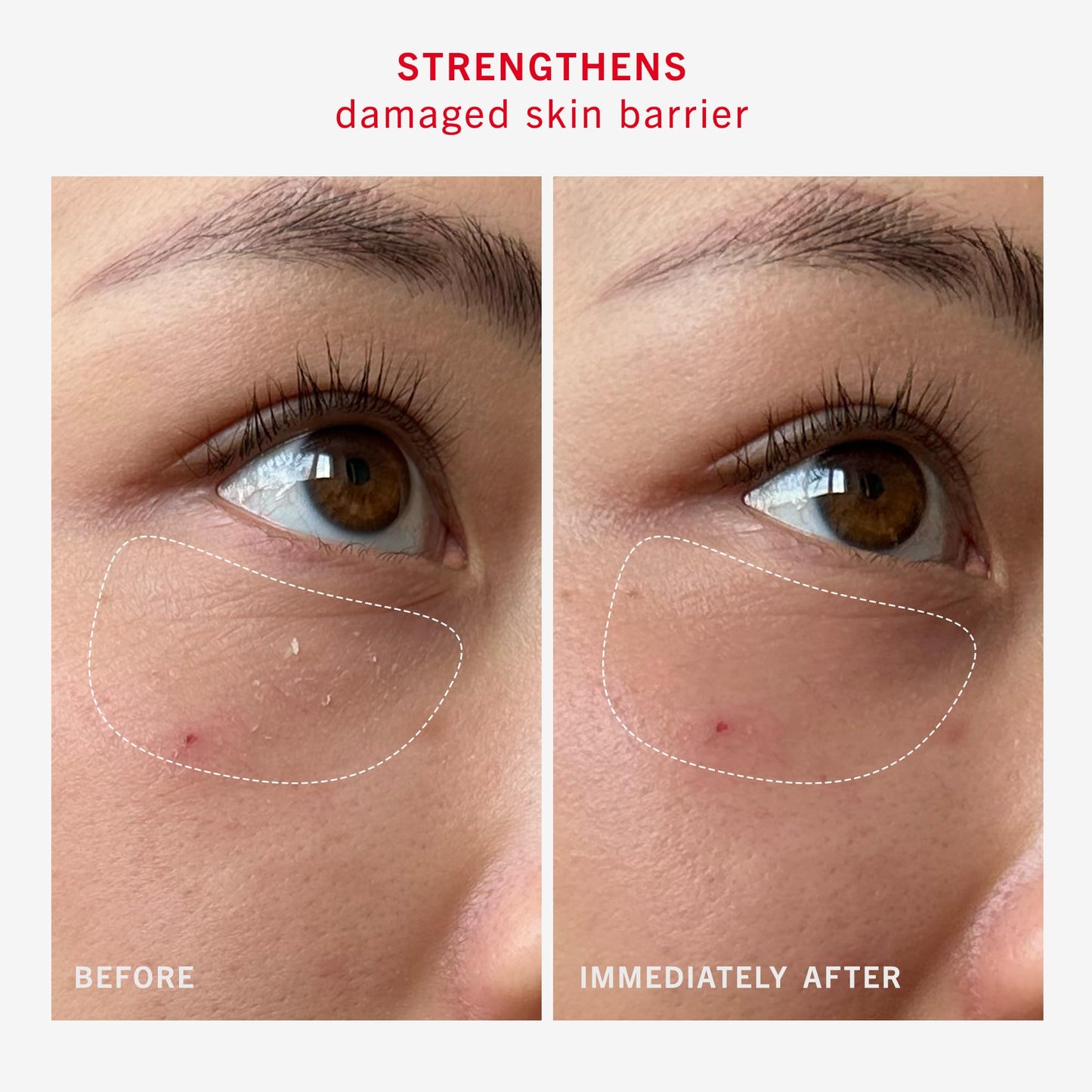 First Aid Beauty - Ultra Repair Rescue Barrier Balm, Deep Hydrating Skin Barrier Mask with 1% Dimethicone, Visible 24-Hour Relief for Dry, Cracked & Chapped Skin, Safe for Sensitive Skin, 2.25 oz