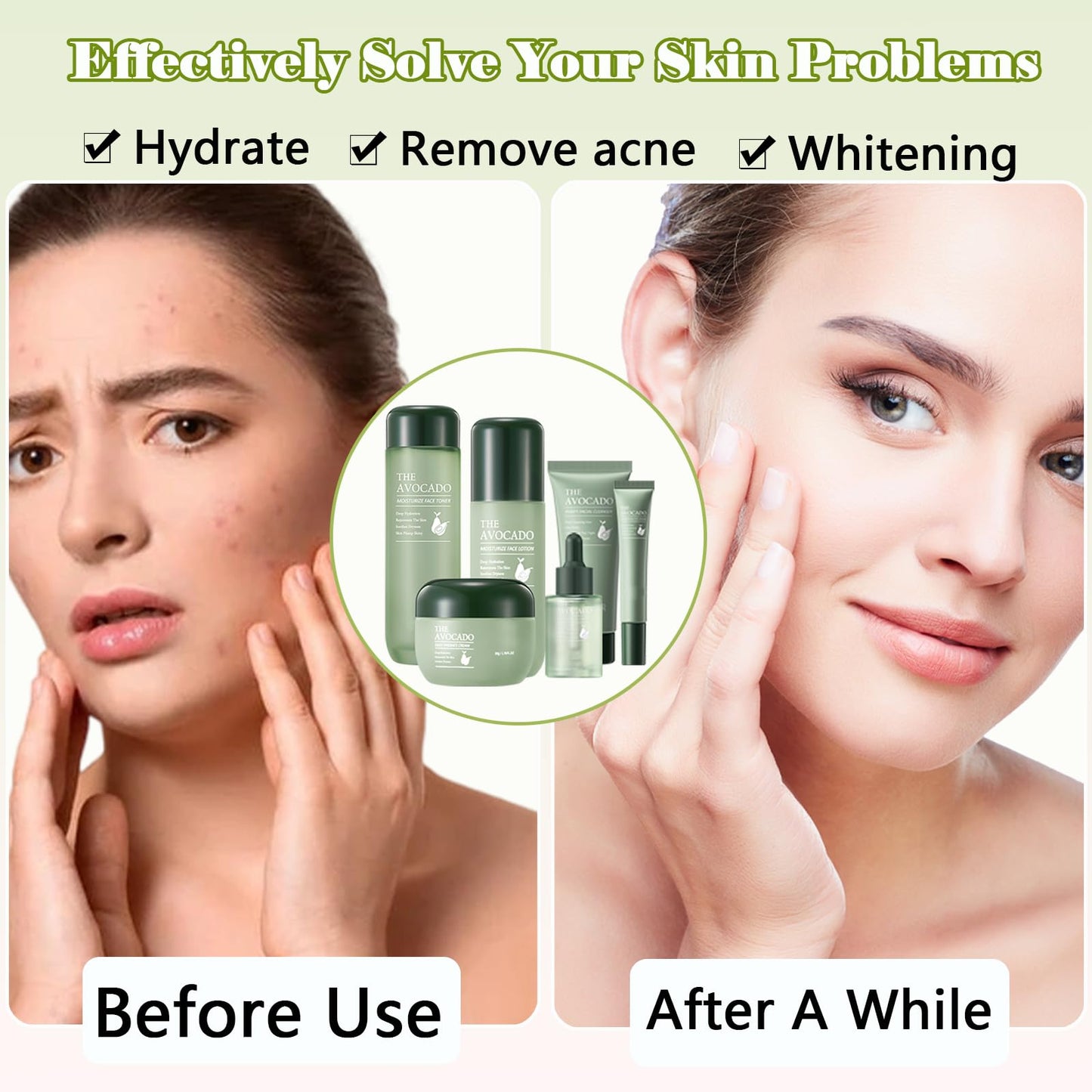 Avocado Skin Care Set for Women,6PCS Skincare Kits with Facial Cleanser, Toner, Serum, Lotion,Cream, Eye Cream, Moisturizing Korean Skincare Set,Anti-Aging Skin Care Set,Birthday Gifts for Women