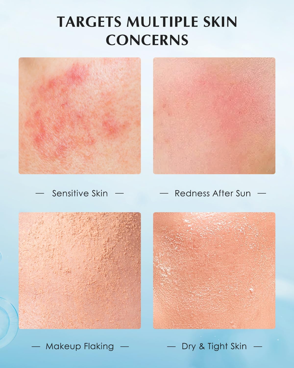 KOMFYMED Recombinant Collagen Restoration One-Day Serum – 4 Types of Collagen & Ectoin, Intensive Barrier Strengthening & Hydration, Single-Use Vials for All Skin Types (1.5ml / 0.05 fl.oz × 5)