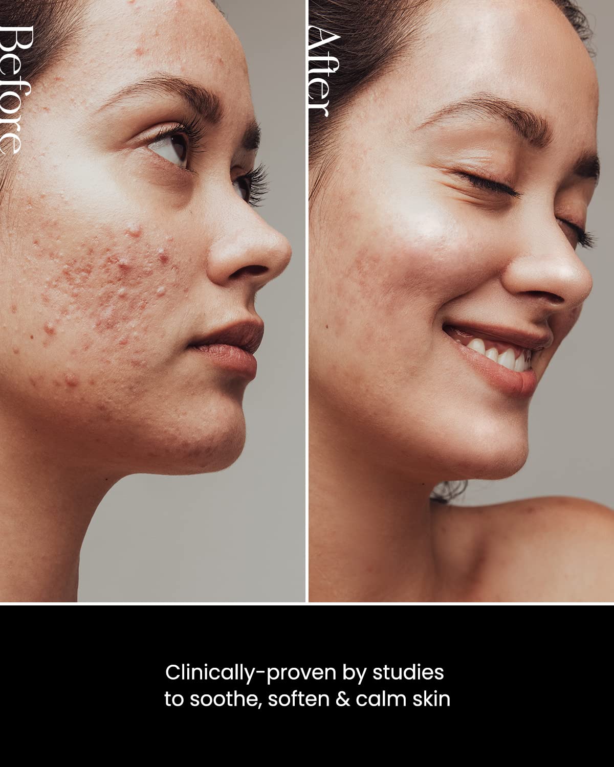 SON&PARK Beauty Water Facia Mist | Multi-Purpose Toner for Face & Body Oil Control Hydrating Exfoliating Skincare Daily Cleansing Booster with Rose & Lavender Oil 100ml(3.4Fl oz)(Mist)