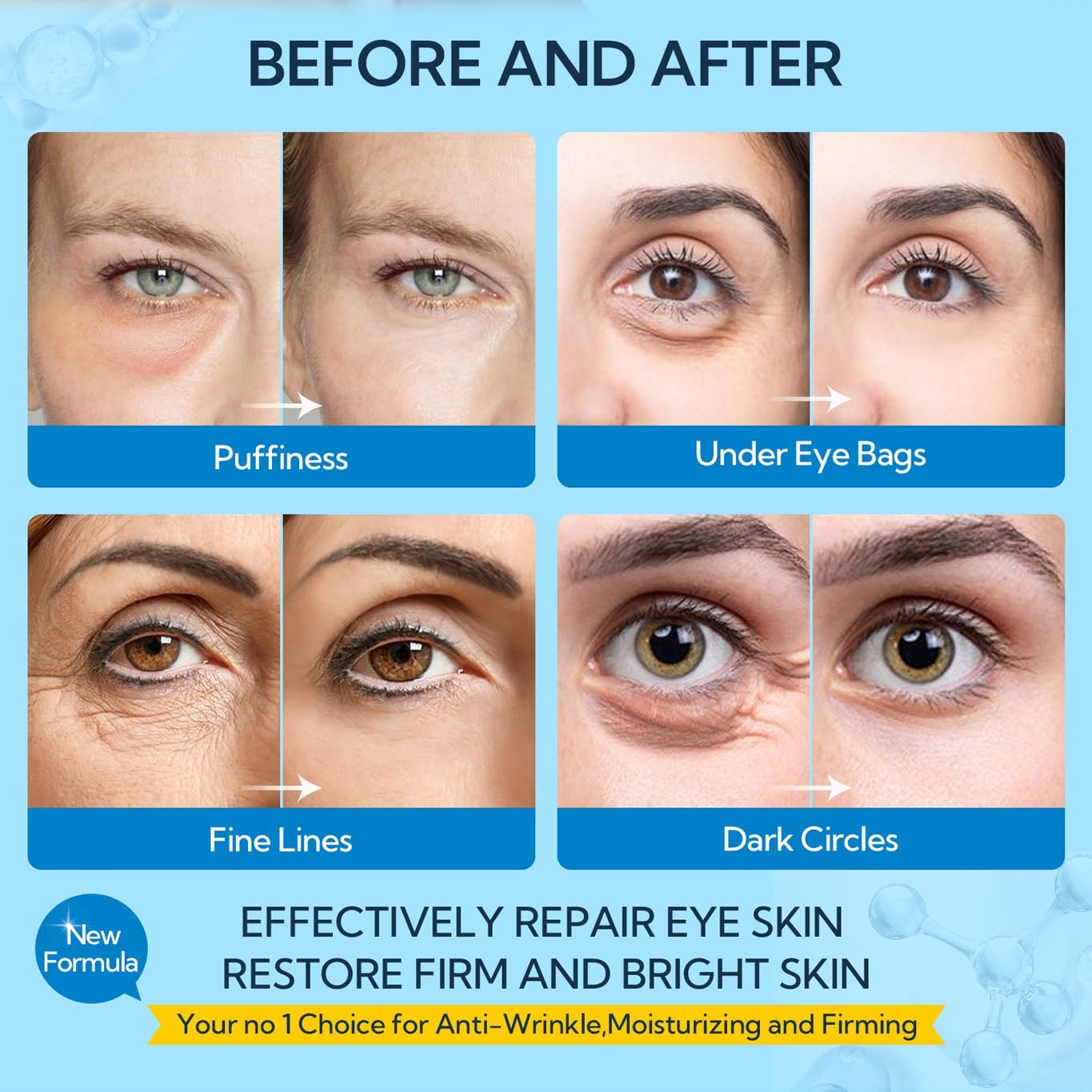 LANBENA Hyaluronic Acid Hydra-Gel Eye Mask Sheet Collagen Eye Patches Skin Care Eye Gel for Moisturizing Remove Dark Circles Eye Bag (30 Pairs)