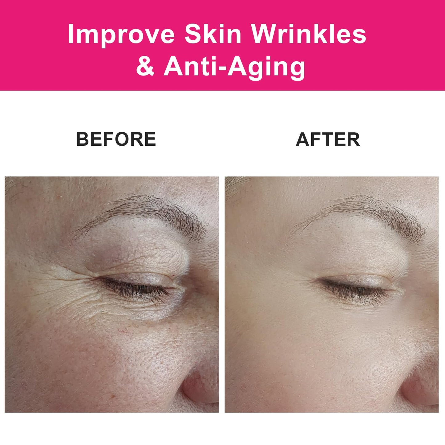 MMPANG Organic Rosehip Seed Oil for Face, USDA Certified, Cold Pressed, Unrefined, 100% Pure Natural Rose Hip Oil (1oz / 30ml) for Anti-Aging, Acne Scar Treatment, Skin & Hair Care, Gua Sha Massage