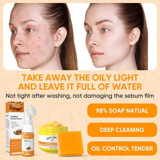 Turmeric Soap Bar and Turmeric Face Cream and Turmeric Face Wash Set for Face & Body, Facial Cleanser, Soothing, Hydrating Skin Care Set for All Skin Type, Cleansing Mousse, Bring a Bubble Net