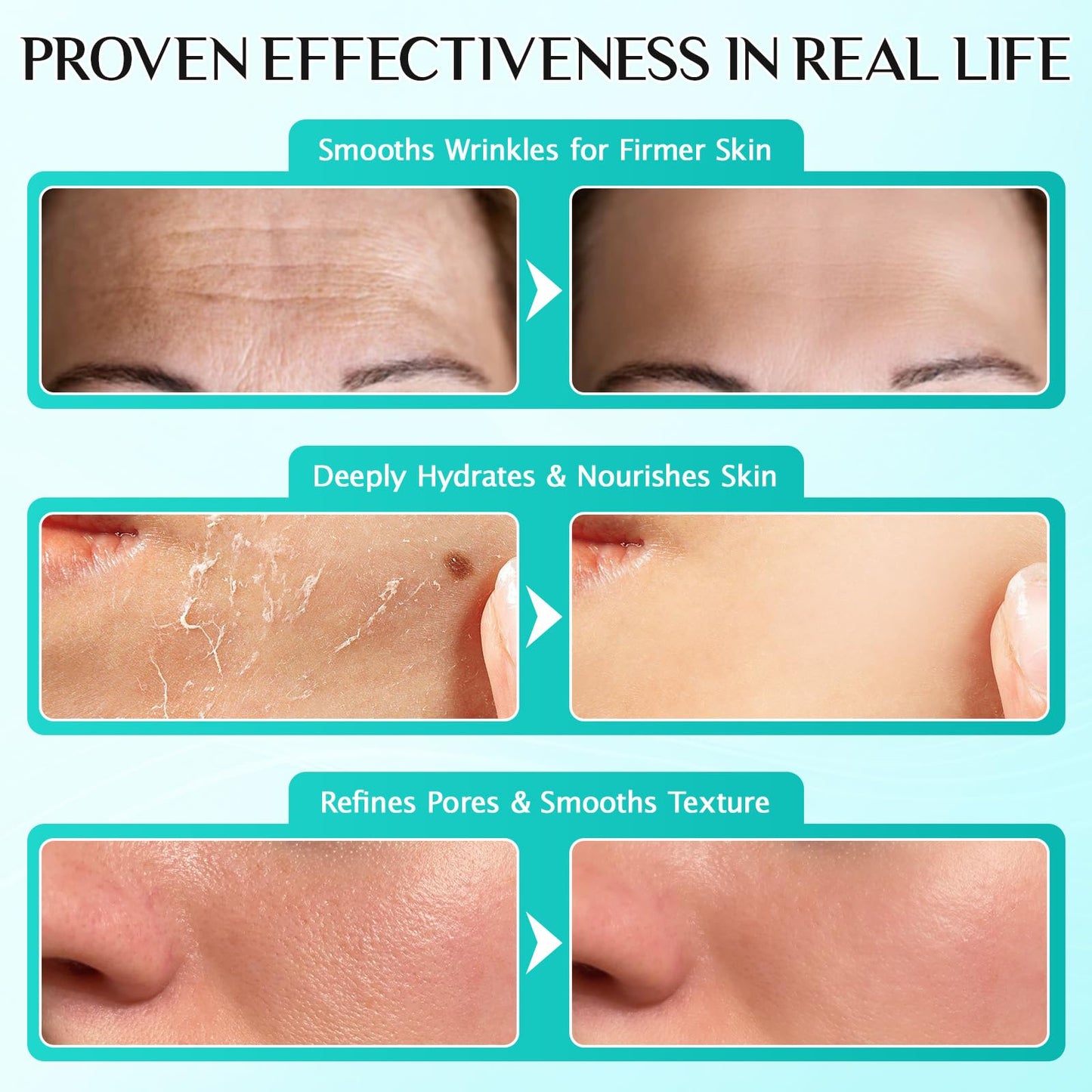 Meifenla 3% Hyaluronic Acid Serum for Face,Ultra-Hydrating Hyaluronic Acid Serum Tube Smooth Skin Deep Moisturizing Facial Serum for Anti-Aging with 30 Pcs Single-Use Vials Design