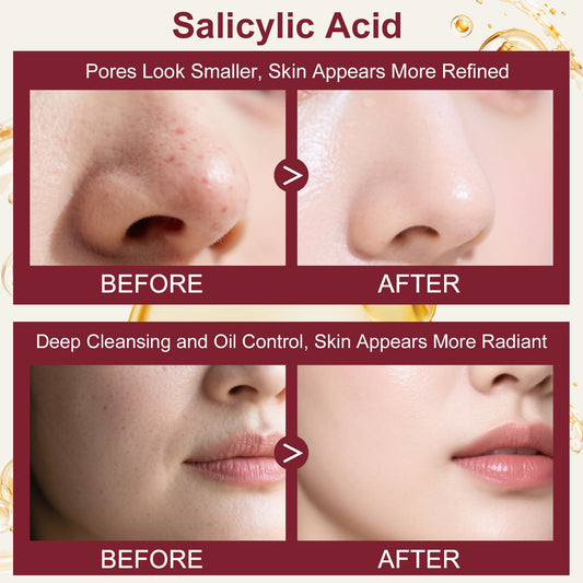 Skin Care for Teens 10-12,Women Skincare Set with Salicylic Acid,Professional Pore Minimizer Soothe, Hydrate, Oil Control, Deep Cleanse Women Facial Skin Care Products,Teen Girls Gifts Trendy Stuff