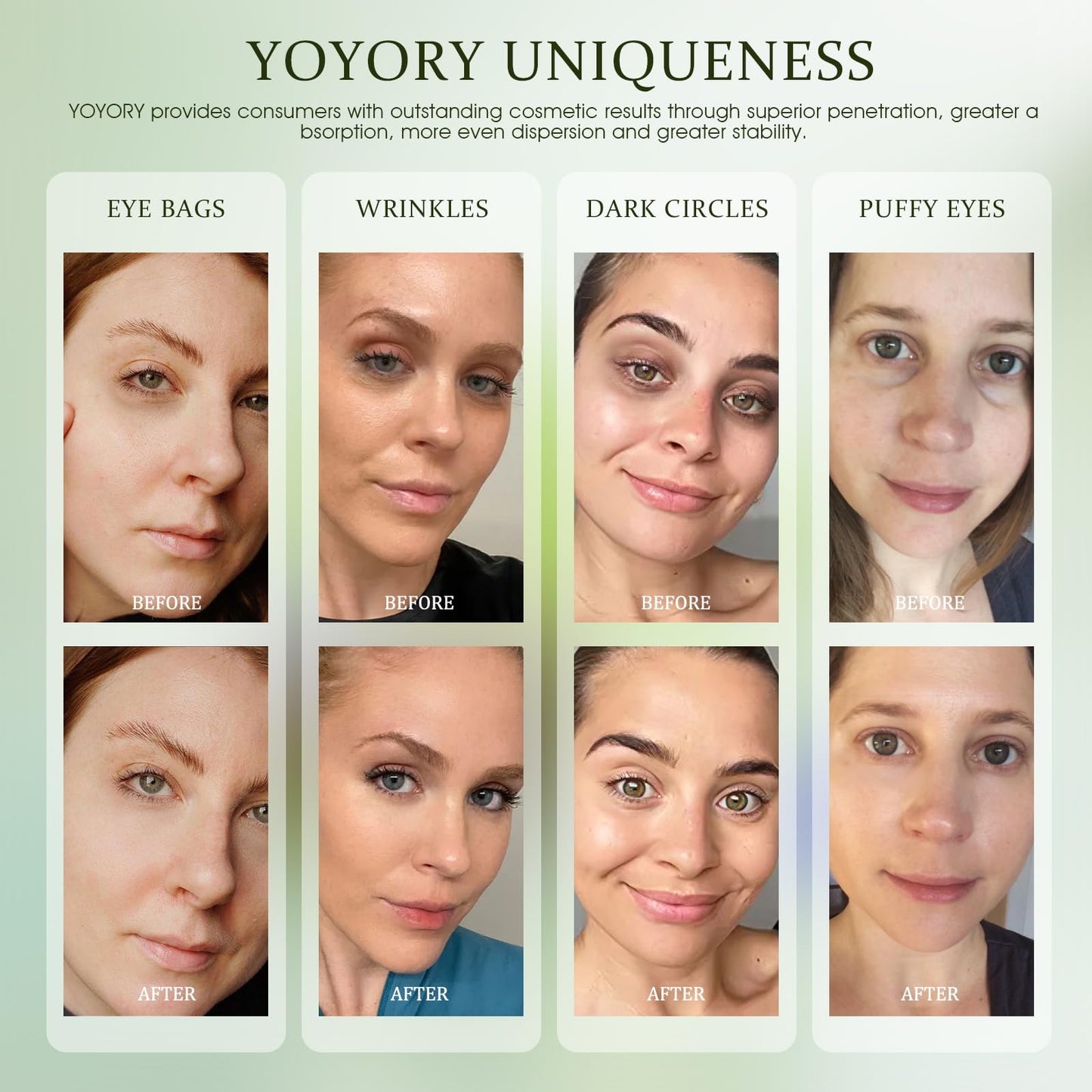 YOYORY Under Eye Patches Masks - for Eye Bags with Collagen and Hyaluronic Acid, Dark Circles,and Fine Lines, Fade Wrinkles Treatment for Women and Men - 60 Pcs Green