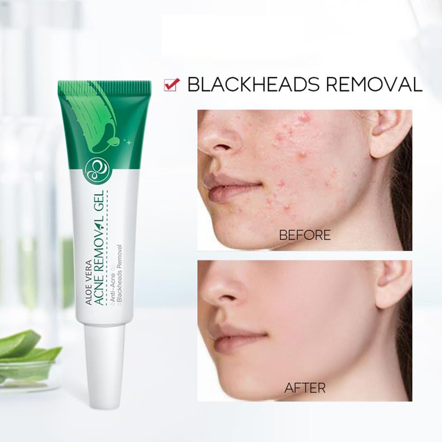 BEUKING Centella Soothing Gel Cream, Deep Hydrating, Botanic Ingredients with Centella Asiatica – Face Moisturizer for Skin Barrier Repair, Firm Skin, Face Moisturizing & Nourishing for Women