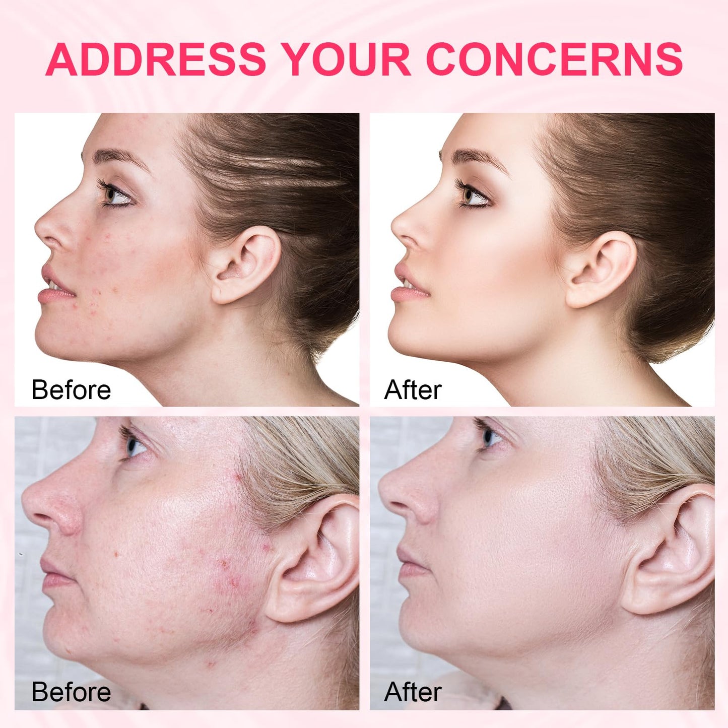 Pink One Day Serum, High-Purity Salmon PDRN, Ultra Hydrating Serum, Non-greasy Formula for Face Brightening, Hydrating, Evens Tone, Smooths Fine Lines (0.05 fl.oz x 10e)