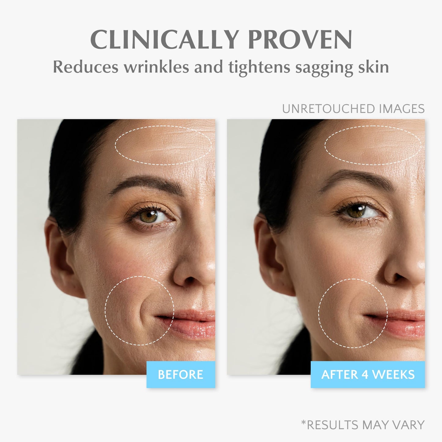 Retinol Anti Aging Face Moisturizer: Wrinkle Cream for Women, Collagen Day Night Repair Cream - Firming, Tightening & Lifting Neck Sagging Skin, 7% Hyaluronic Acid for Max Hydration, 1.7 Oz