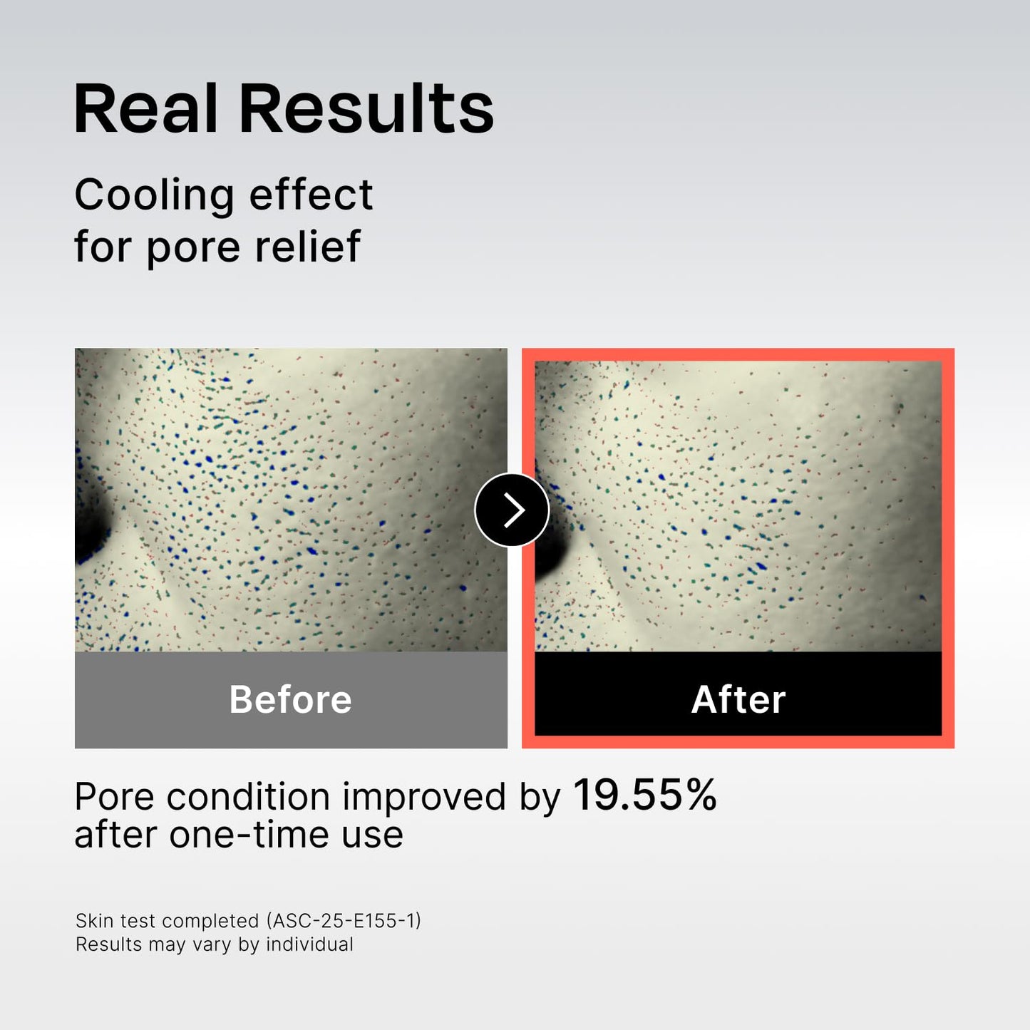 Celladix 131 Hyaluronic Cooling Toner, Korean Skincare Facial Toner with Panthenol, Squalane & Botanical Complex- Instant Soothing, Hydrating & Oil Control for Sensitive & Acne-Prone Skin, 10.1 Fl Oz