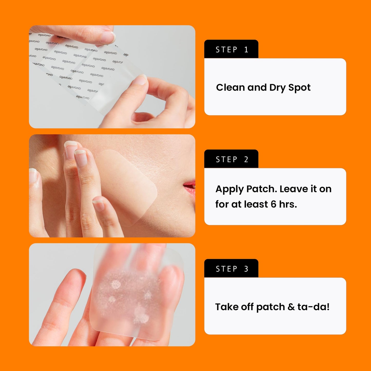 AVARELLE Acne Patches XL, Acne Cover Patch Large | Pimple Patches for Face Cheek & Nose (8 Count) | Large Hydrocolloid Acne Treatment with Tea Tree, Calendula, & Cica