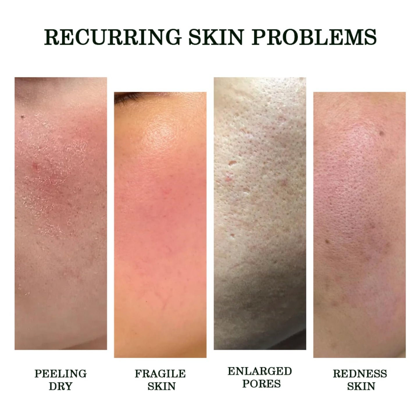 NICEFACE Centella Releaf Serum, Soothing, Calming, Facial Serum for face, Vegan & Cruelty-Free