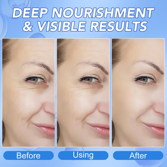 GOGIFTGO Collagen Face Mask,Collagen Real Deep Mask,Collagen Mask,Deep Hydrating Anti Wrinkle Lifting Mask,Hydrogel Masks for All Skin Types 34g*4ea