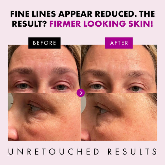 Collagen Anti Aging Face Cream with Patented Matrixyl-3000 & Argireline - 5x More Powerful w/ Pep-Boost Peptide Complex + 10 Antioxidants - Facial Wrinkle Day/Night Cream Face Moisturizer for Women