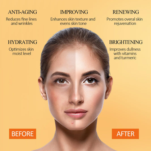 Vitamin C Face Mask with Kaolin Clay and Turmeric for Dark Spots, Dull Skin, Skincare Facial Mask for Controlling Oil and Refining Pores 5.29 Oz