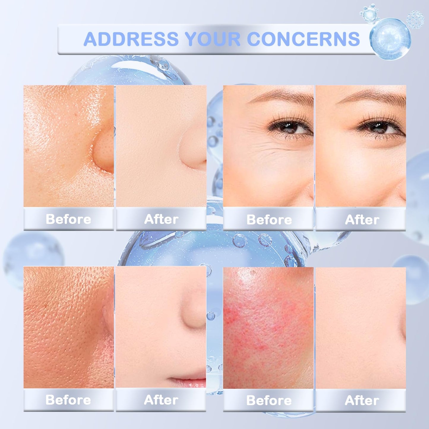 3% Hyaluronic Acid Serum, 30Pcs Hyaluronic Acid Tubes, Ultra-Hydrating Serum Single-Use Vials, Hyaluronic Acid Tubes 3% for Women's Moisturizing Skin Care Face