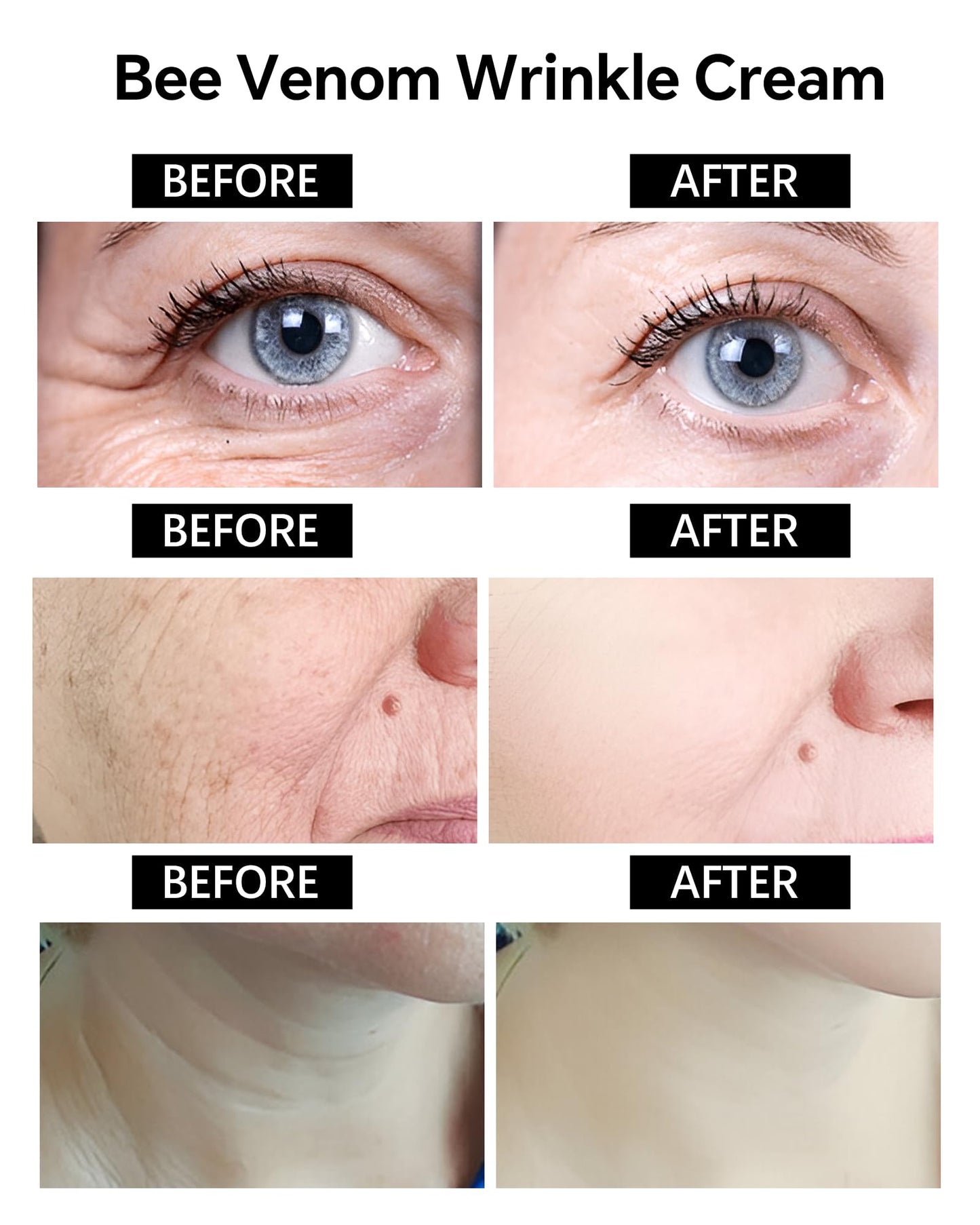 Bee Venom Wrinkle Removal Cream – Anti-Aging, Firming, Lifting, and Moisturizing Skin Cream for All Skin Types – Recovery and Anti-Wrinkle Care