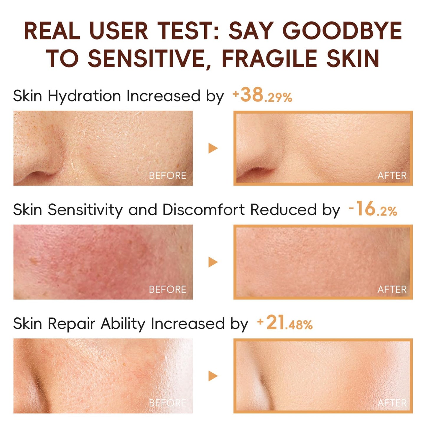 Rice Skincare Set for Teen Girl Gifts Birthday - Skin Care for Teens 10-12 - Hydrating Skin Care Routine Kit for Women - Gifts Birthday Facial Kit for Women - Skin Care Set with Cleanser,Serum