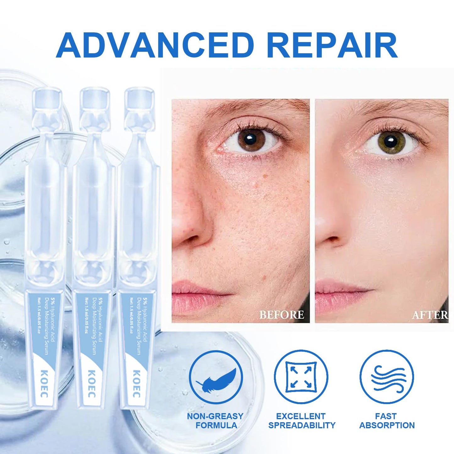 5% Hyaluronic Acid Serum Ultra-Moisturizing Vials,Hyaluronic Acid Facial Serum, Single-Use Hyaluronic Acid Tubes,Intensive Hydration,Enhances Skin Elasticity,Pre-Makeup Moisturizing Care (1 Box of 30)