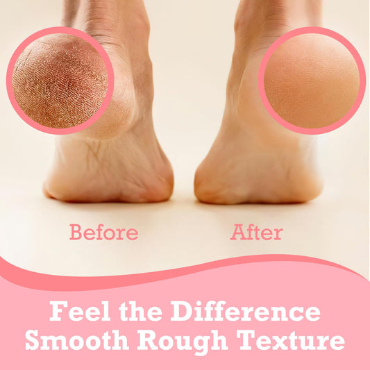 AIFUFAND Crack Feet Prevention Stick Duo (2PC) | Hydrating & Moisturising Heel Balm Stick | Softening and Nourishing Cream for Dry Heels, Hands & Elbows | Plant-Based Gentle Skin Care (Pink & Blue)