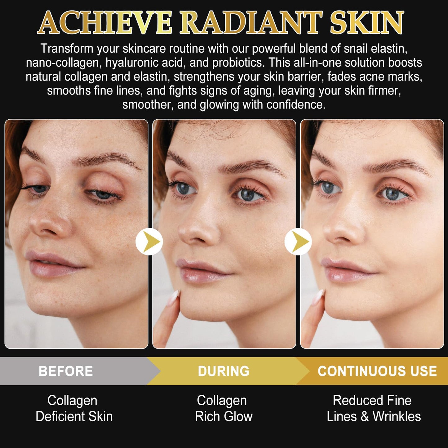 ITSDAWN 6 Pack Advanced Snail Mucin Glass Glow Face Masks, Collagen Face Mask, Hydrating Overnight Hydrogel Mask for All Skin Types