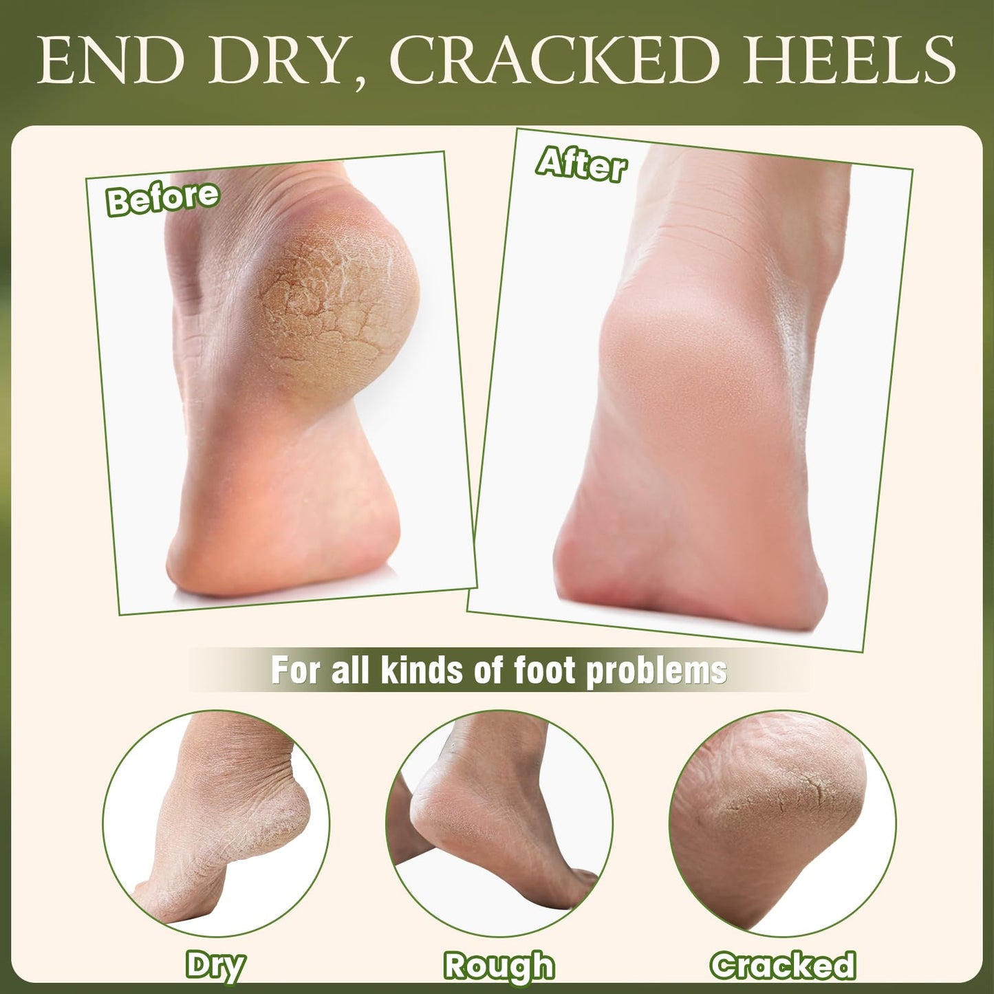 4 Pcs Cracked Heel Repair Set –Comes with 2 Repair Sticks & 2 Foot Care Socks, Rose & Jojoba Oil Heel Balm for Dry Cracked Feet, No-Mess Applicator, Travel-Friendly